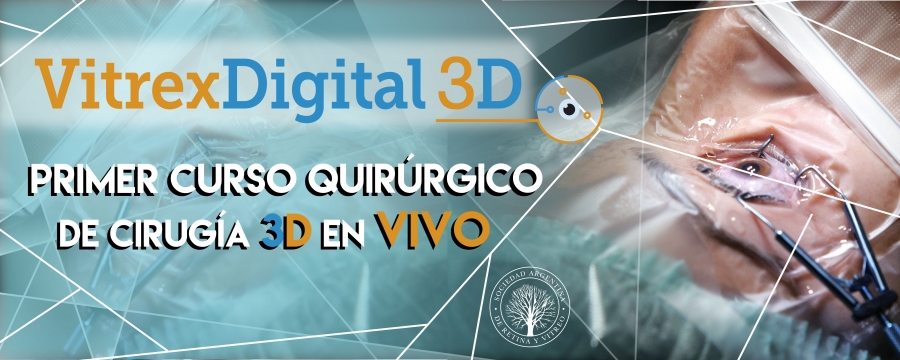 Vitrex-Digital-3D