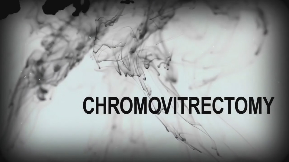 Chromovitrectomy